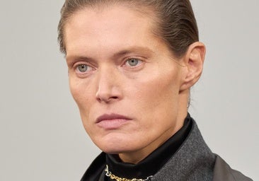 Mejillas caídas: el problema que envejece el rostro y mejora con medicina estética